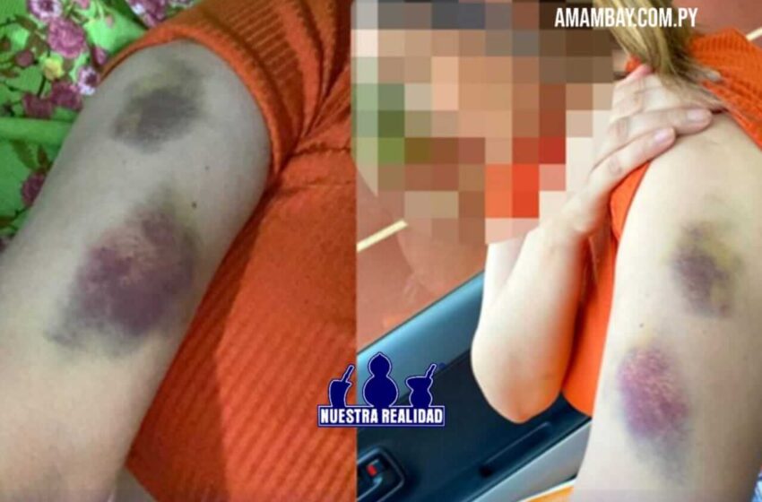 La humilló, golpeó y amenazó de muerte: denuncian a policía por ataque a su ex